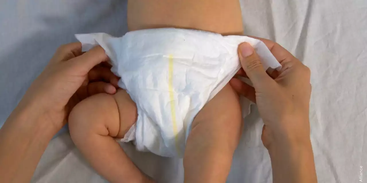 Cloth diapers vs. disposable diapers: Which is better for preventing diaper rash?